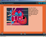 Organ Transplant Information System  Webseite